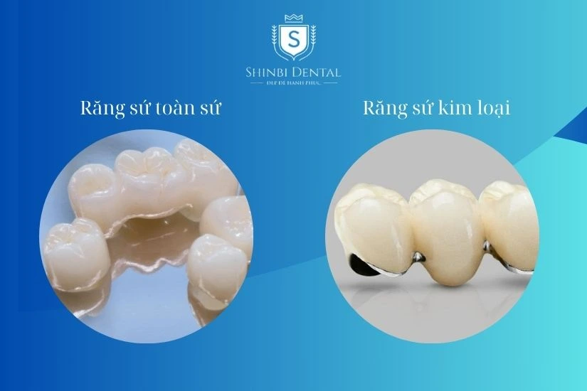 Lựa chọn vật liệu sứ phù hợp với nhu cầu và điều kiện kinh tế
