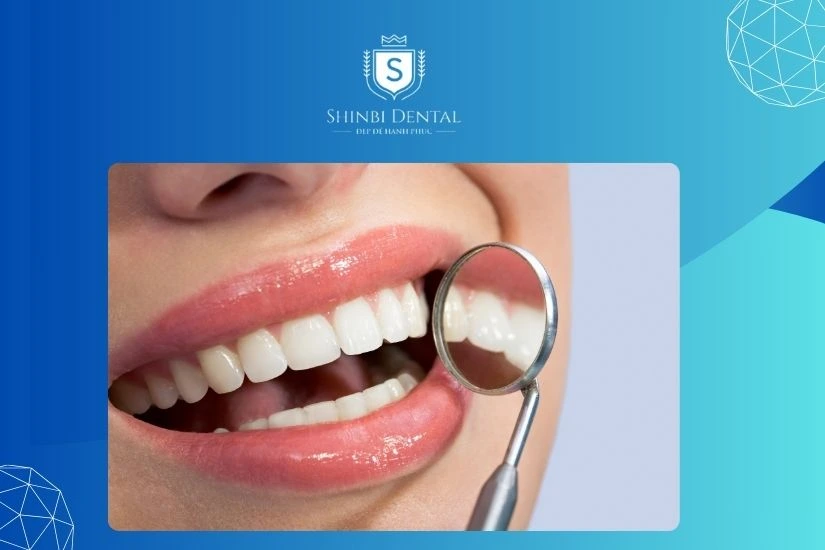 Bọc sứ cho răng hô tùy vào từng trường hợp