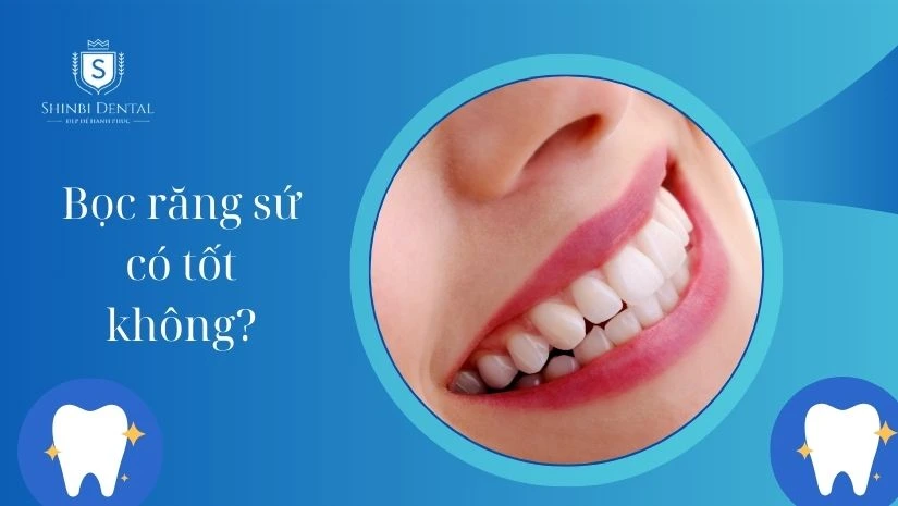 Bọc răng sứ có tốt không? Ưu nhược điểm khi bọc sứ
