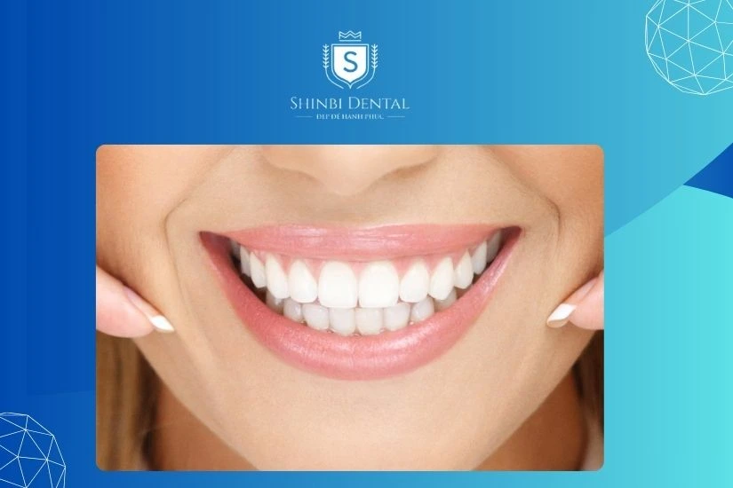 Bọc răng sứ tại nha khoa uy tín để đảm bảo an toàn và hiệu quả Bọc răng sứ tại nha khoa uy tín để đảm bảo an toàn và hiệu quả