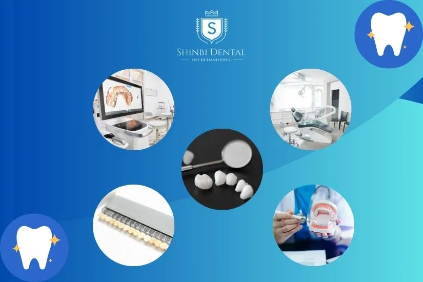 Chi phí bọc răng sứ thẩm mỹ phụ thuộc vào nhiều yếu tố