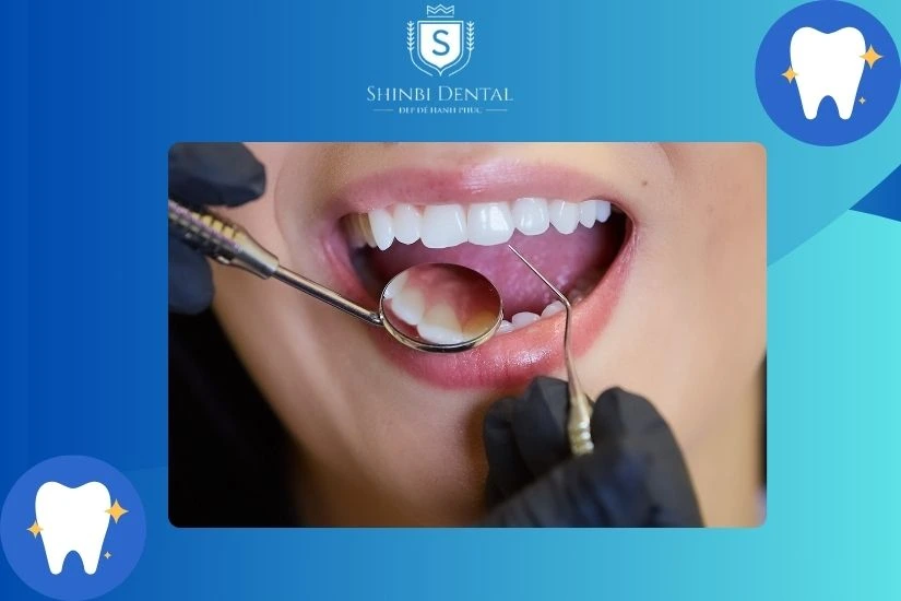 Bệnh nhân bọc răng sứ cần thăm khám nha khoa định kỳ