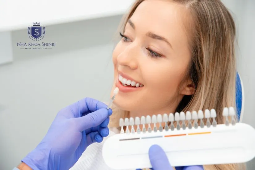 Dán sứ veneer được bao lâu