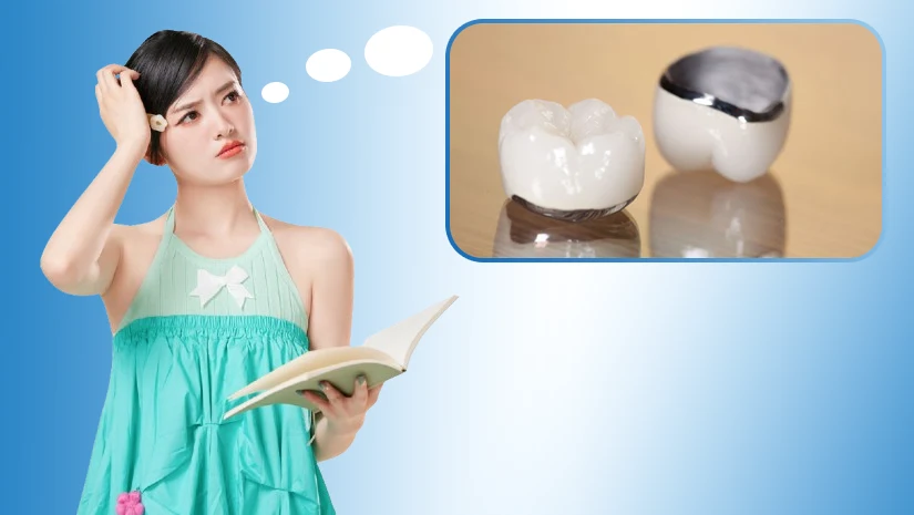 Giá bọc mão răng sứ: Bảng chi phí và các yếu tố ảnh hưởng