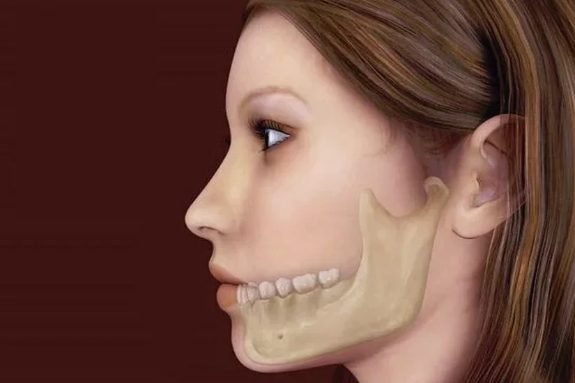 mất cấu trúc răng tự nhiên