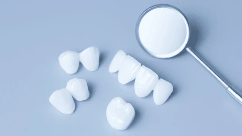 răng sứ cao cấp