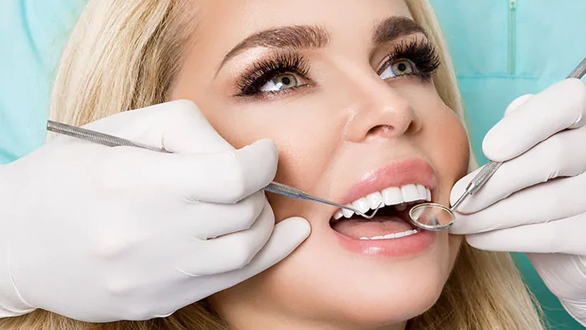 Tác hại của dán sứ Veneer cho răng ở địa chỉ không uy tín