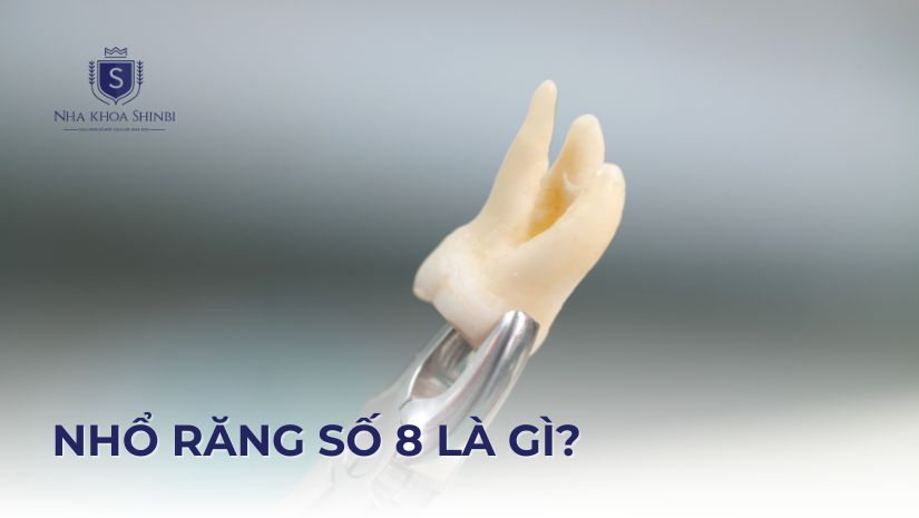 Nhổ răng số 8 là gì? Quy trình và lưu ý khi thực hiện