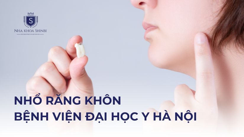 Nhổ răng khôn bệnh viện Đại học Y Hà Nội giá bao nhiêu?