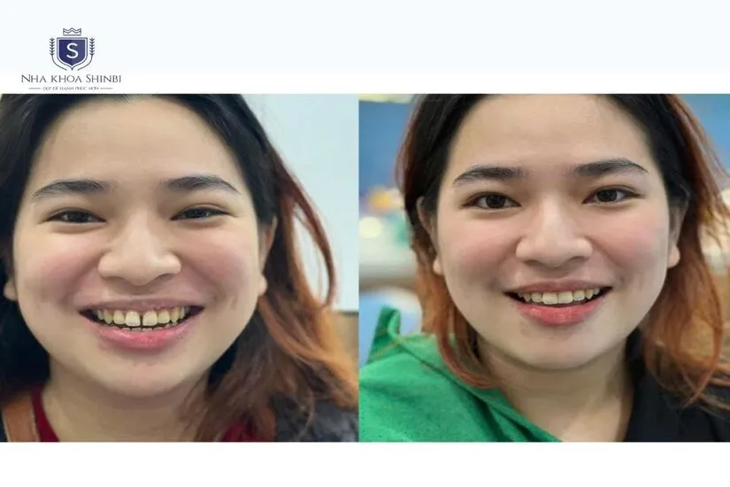 Tính thẩm mỹ cao Tính thẩm mỹ cao