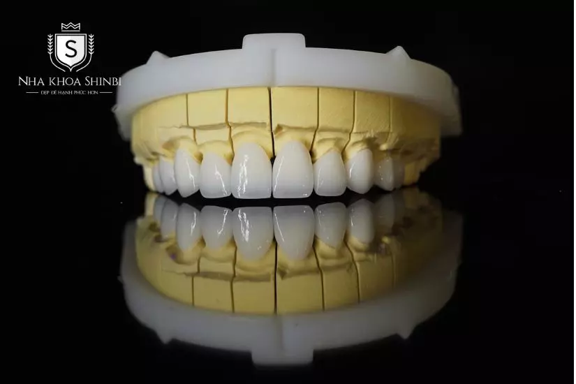 Bọc răng sứ Hàn Quốc mang đến nhiều ưu điểm vượt trội