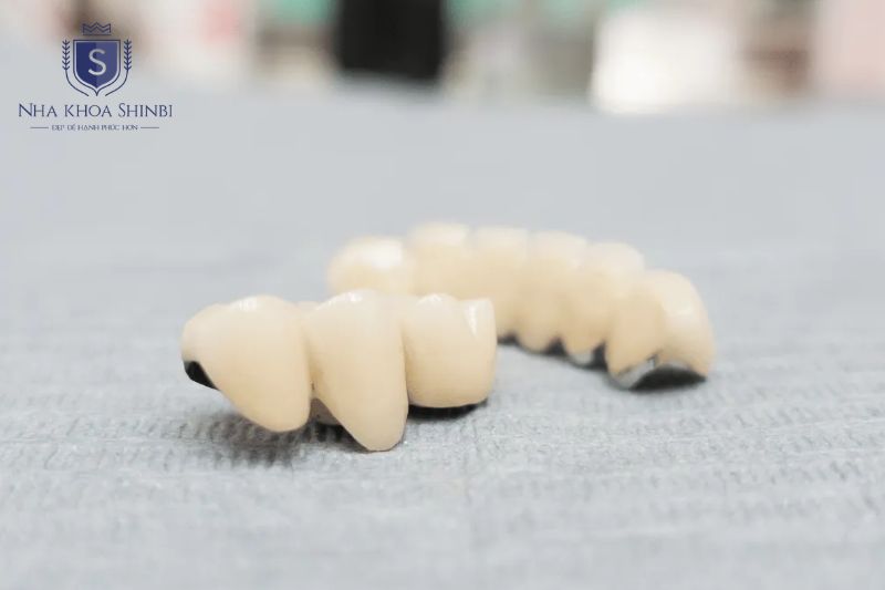 Bác sĩ gắn abutment lên trụ titanium và lấy dấu hàm để lab chế tác mão sứ