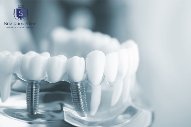 Bác sĩ gây tê cục bộ vùng phẫu thuật và phẫu thuật đặt trụ titanium