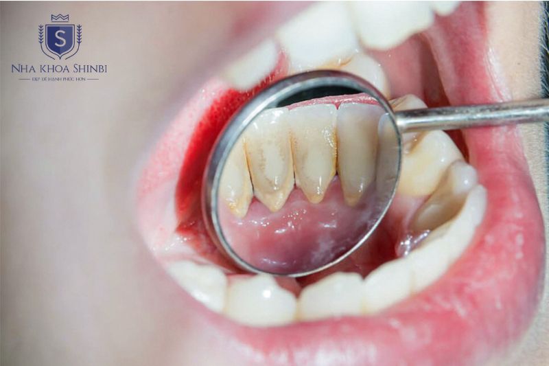 Bác sĩ kiểm tra tổng quát sức khỏe răng miệng