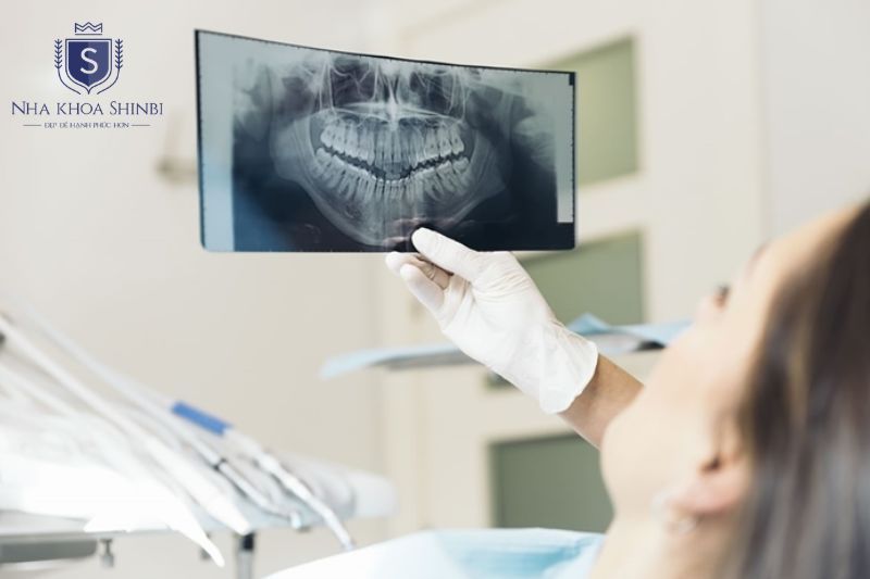 Chuẩn bị tâm lý thoải mái trước khi trồng răng implant