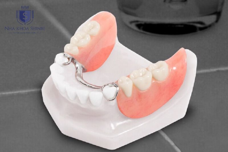 Hàm tháo lắp phù hợp nhất với người cao tuổi mất toàn bộ hoặc gần toàn bộ răng