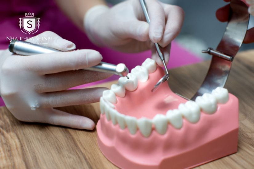 Quy trình làm răng sứ Ceramill