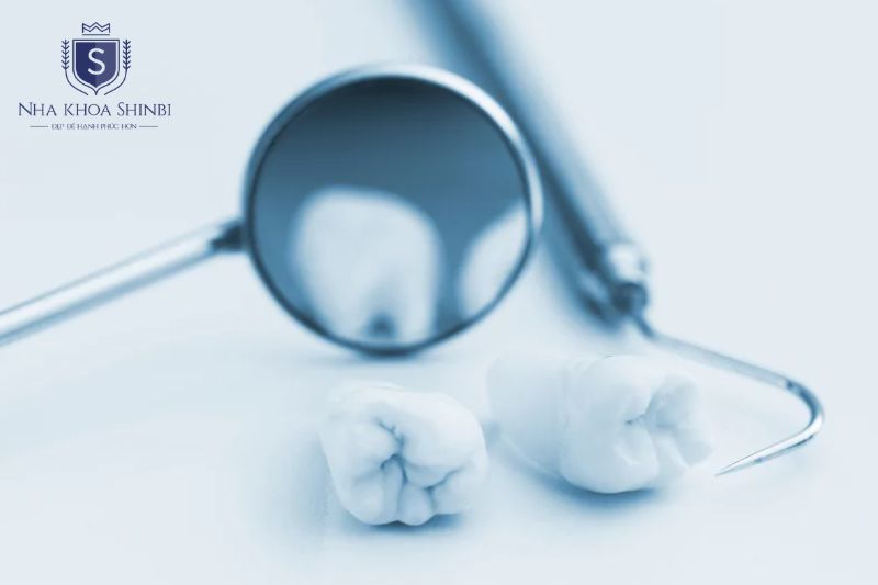 Tái khám định kỳ để kiểm tra trực tiếp tình trạng tích hợp xương và mô nướu quanh implant