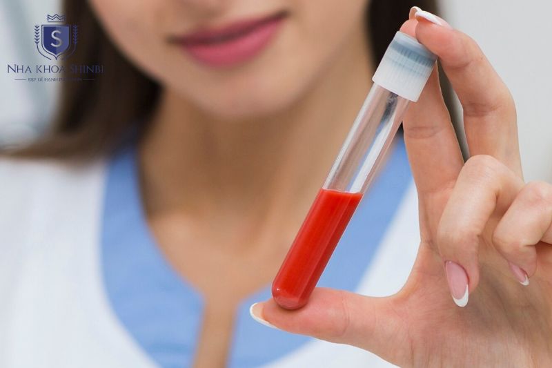 Xét nghiệm máu và lập phác đồ điều trị cá nhân hóa