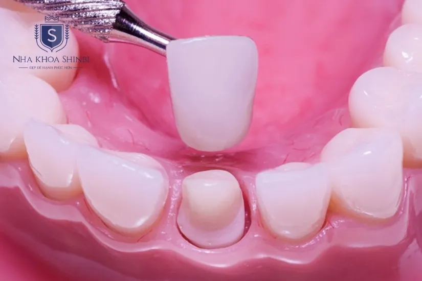 Chất liệu thuần sứ, màu sắc tự nhiên Chất liệu thuần sứ, màu sắc tự nhiên
