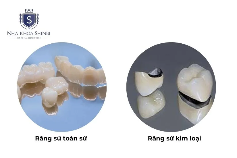 Chọn loại răng phù hợp Chọn loại răng phù hợp