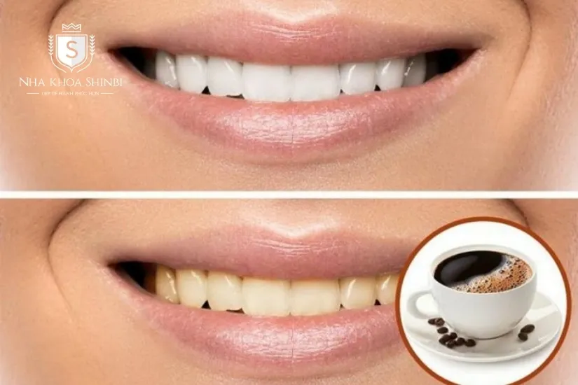 Chú ý về chế độ ăn uống Chú ý về chế độ ăn uống