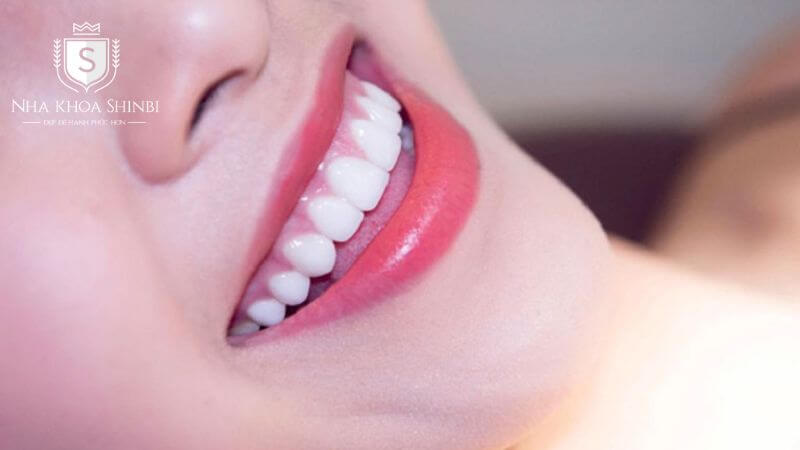 Các loại răng sứ Zirconia phổ biến Các loại răng sứ Zirconia phổ biến