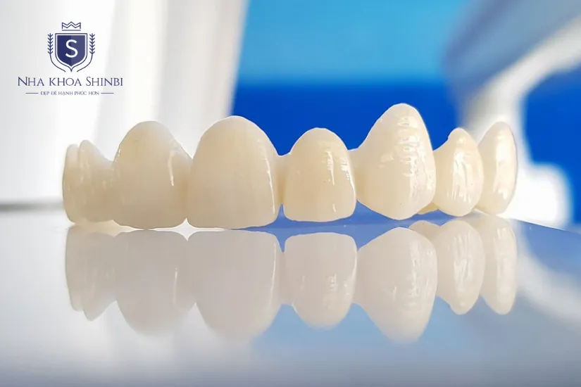 Có nên làm răng sứ thẩm mỹ giá rẻ không?