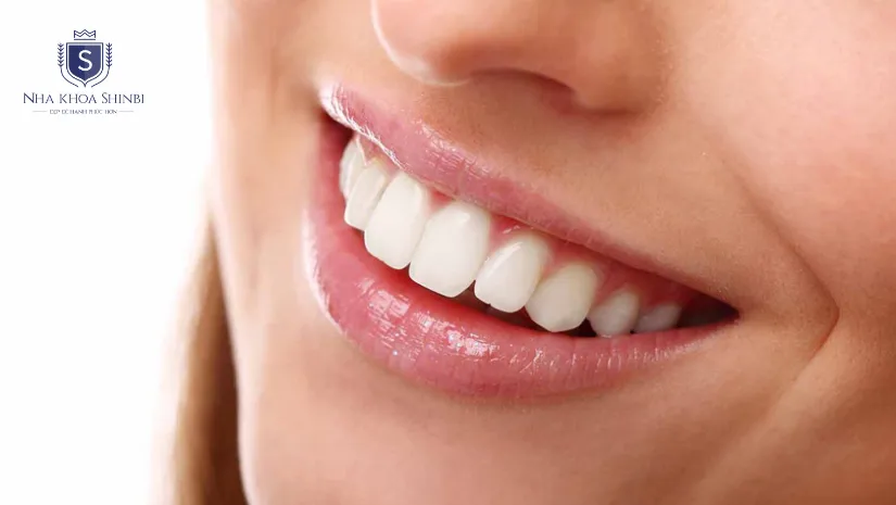 Giá răng sứ thẩm mỹ bao nhiêu tiền? Bảng giá cập nhật 2025