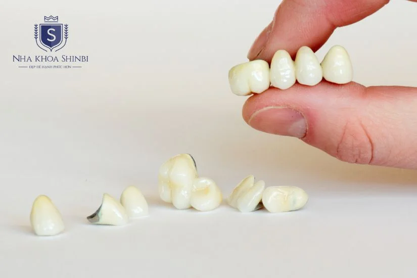 Làm cầu răng sứ có tốt không? Làm cầu răng sứ có tốt không?