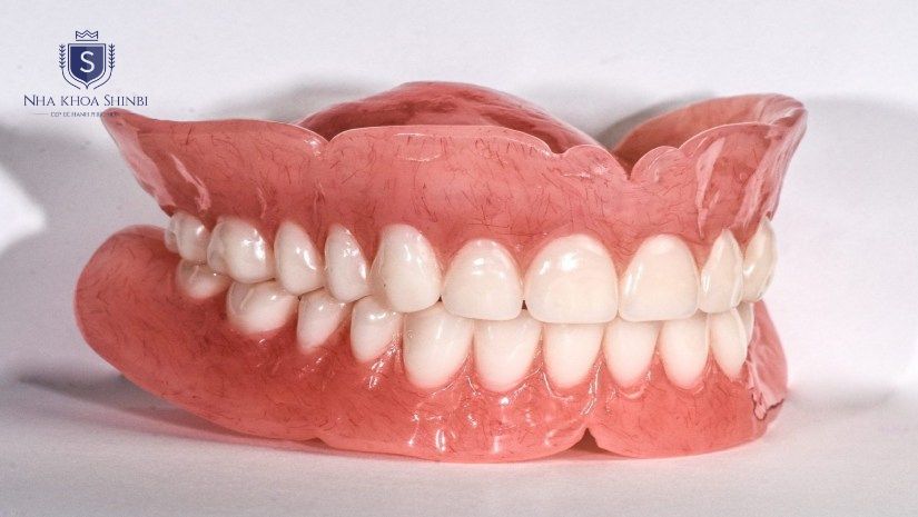 Làm răng sứ tháo lắp là gì Làm răng sứ tháo lắp là gì