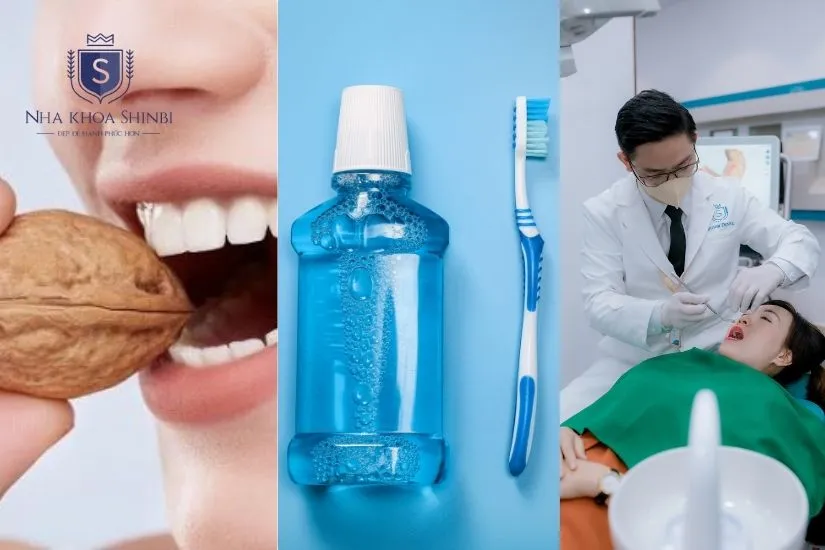 Lưu ý để tránh tác hại của việc làm răng sứ Lưu ý để tránh tác hại của việc làm răng sứ