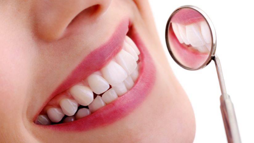 Lưu ý trước khi bọc răng sứ cho người mới cần biết