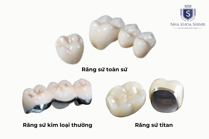 Lựa chọn loại răng sứ phù hợp