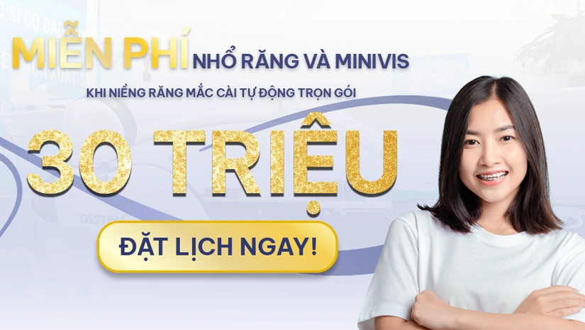 niềng răng mắc cài tự động trọn gói chỉ 30 triệu niềng răng mắc cài tự động trọn gói chỉ 30 triệu