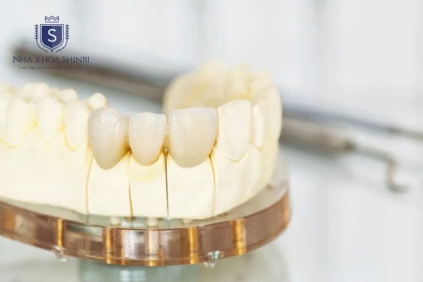 Răng sứ Đức Ceramil Răng sứ Đức Ceramil