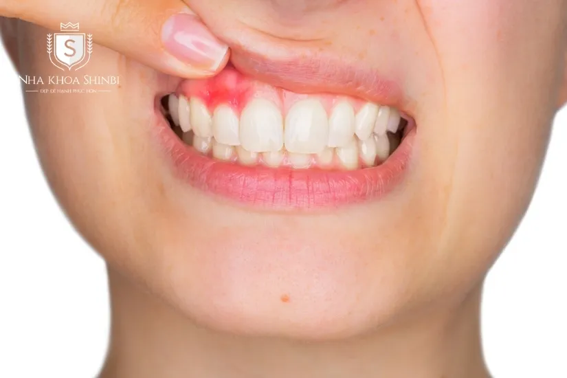 Tuổi thọ lên đến 20 năm Tuổi thọ lên đến 20 năm