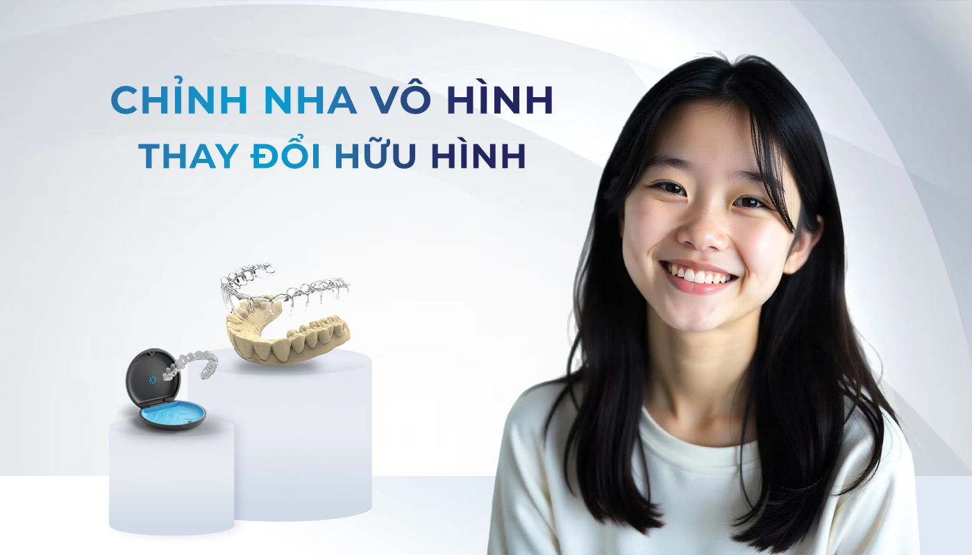 Niềng trong suốt Invisalign Lite một hàm