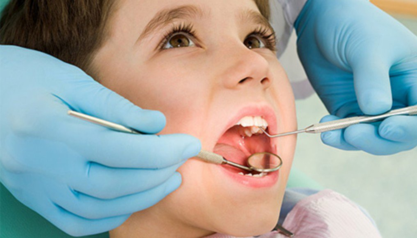 Trám răng sữa bị sâu