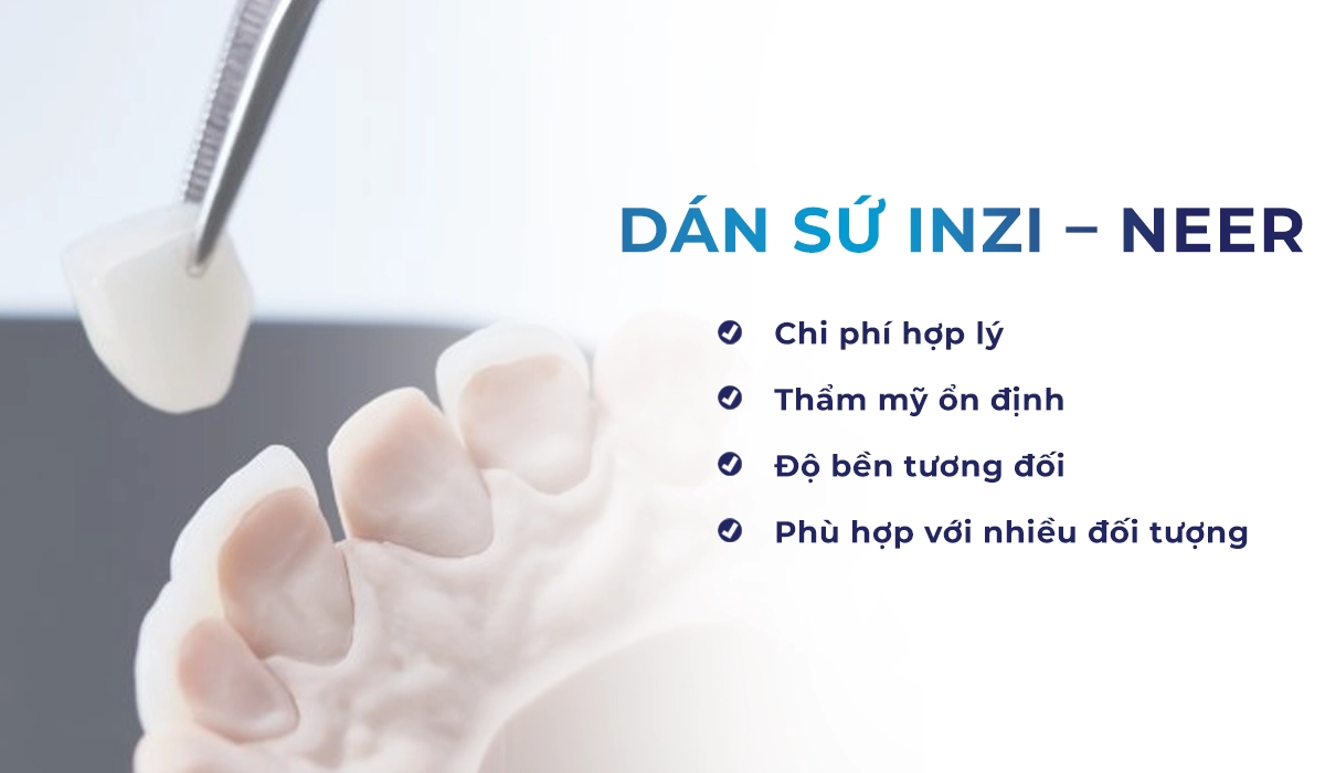 Dán sứ Inzi – Neer