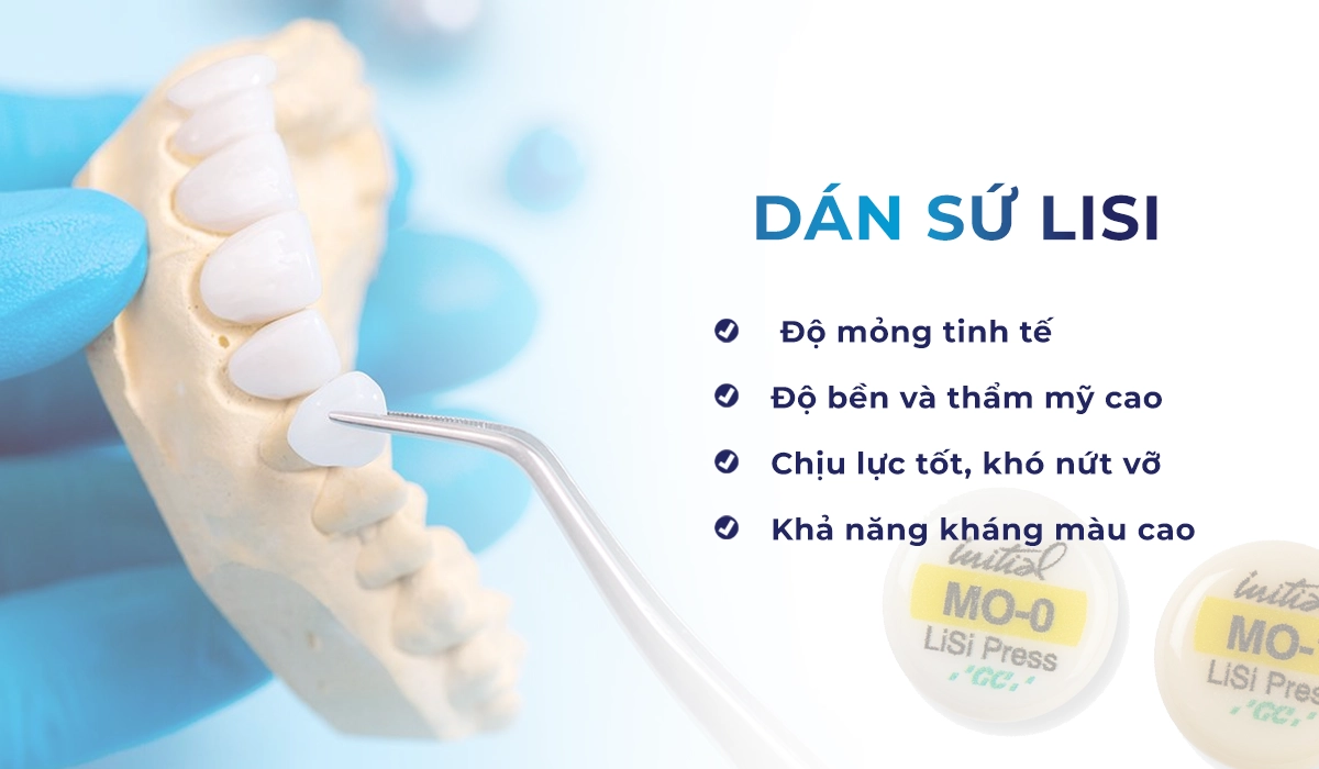 Dán sứ Lisi