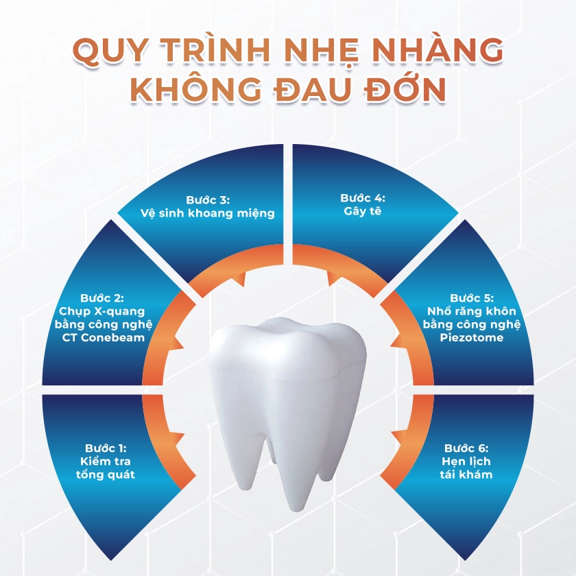 Nhổ răng thường nhiều chân
