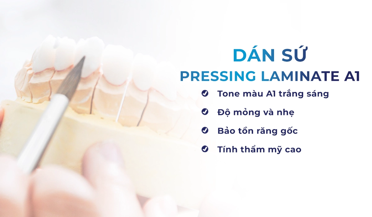 Dán sứ Pressing Laminate A1