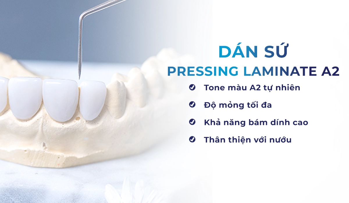 Dán sứ Pressing Laminate A2