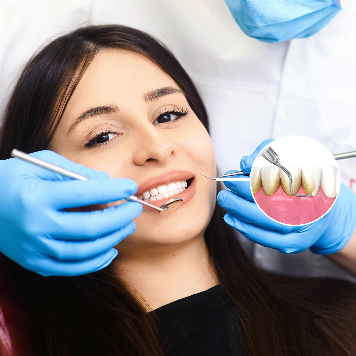 Hàn răng thẩm mỹ khe thưa, lỗ rãnh lớn, rìa cắn,…
