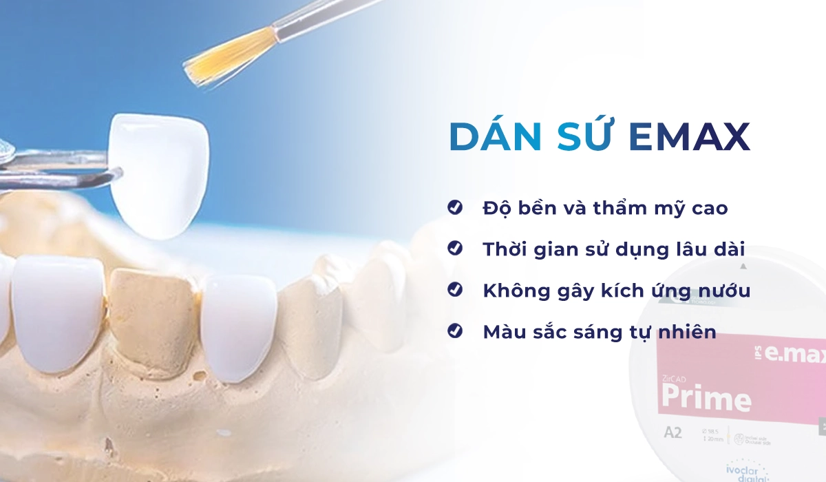 Dán sứ Emax