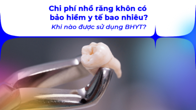 Chi phí nhổ răng khôn có bảo hiểm được hưởng mức bao nhiêu?