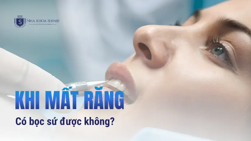 Bọc răng sứ khi mất răng có được không? [Bác sĩ giải đáp]