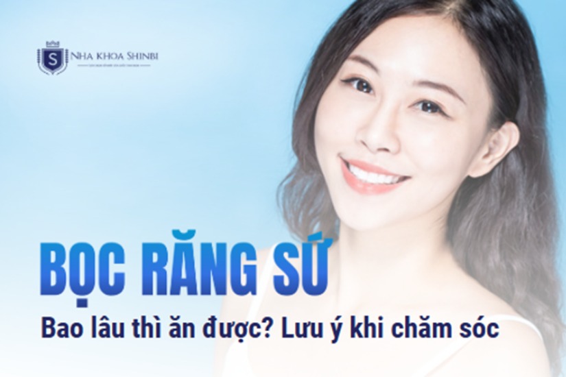 Bọc răng sứ bao lâu thì ăn được? Lưu ý khi chăm sóc răng sứ Bọc răng sứ bao lâu thì ăn được? Lưu ý khi chăm sóc răng sứ