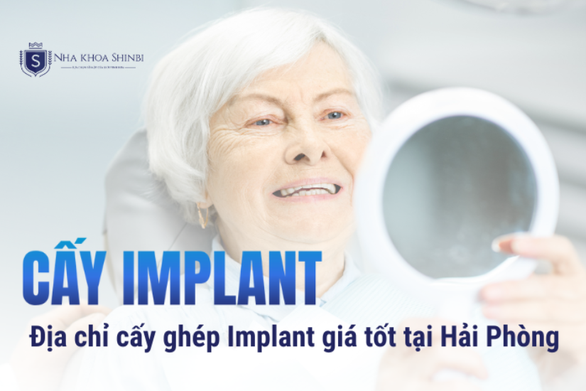 Địa chỉ cấy ghép Implant uy tín tại Hải Phòng Địa chỉ cấy ghép Implant uy tín tại Hải Phòng